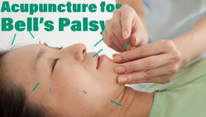 Woman Facial Acupuncture