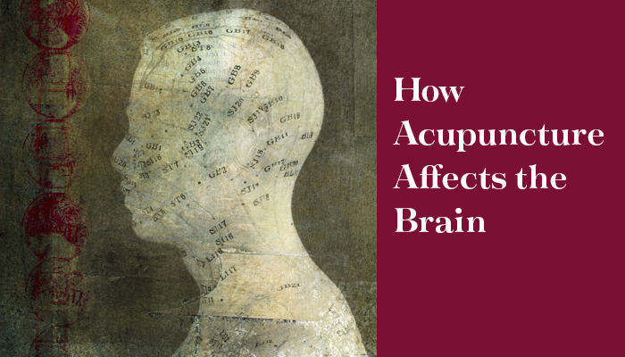 How Acupuncture affects the brain header image for blog