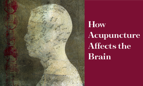 How Acupuncture affects the brain featured image