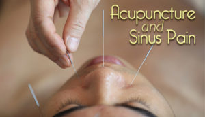 Acupuncture and Sinus Pain