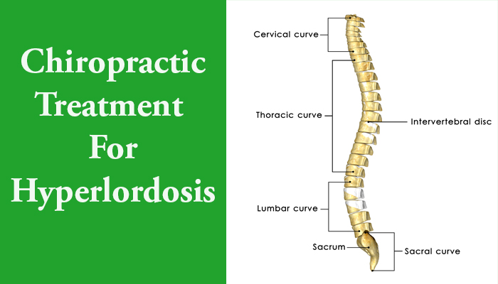 hyperlordosis exercises