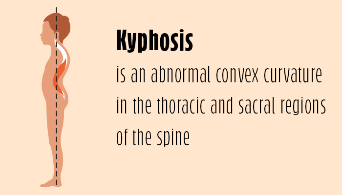 Image of the definition of the word Kyphosis 