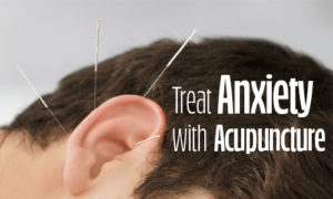 Image of acupuncture in an ear with title