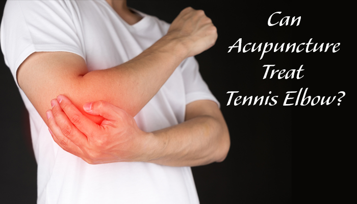 https://chiroacupunctureelgin.com/wp-content/uploads/2019/04/Main-blog-tennis-700x400.jpg