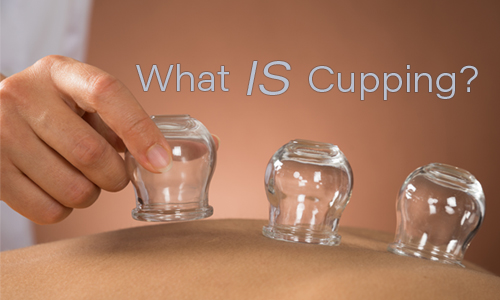 What is Cupping