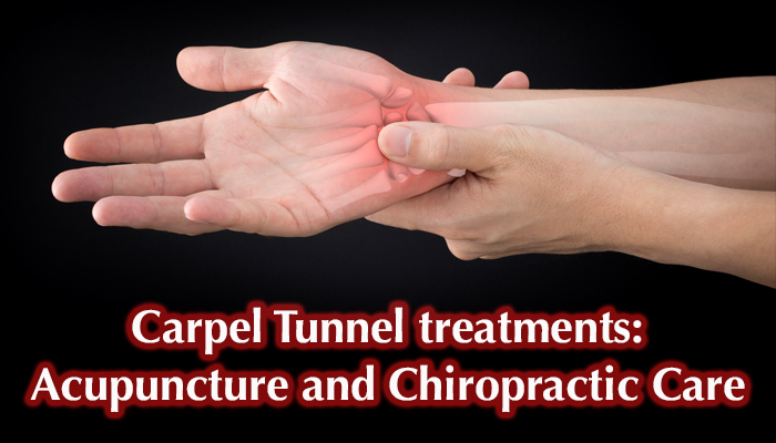 Carpal Tunnel can be treated by Acupuncture & Chiropractic