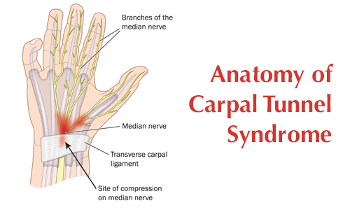 Carpal Tunnel Syndrome in BC - Una Vita Chiropractic