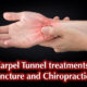carpal tunnel pain in wrist