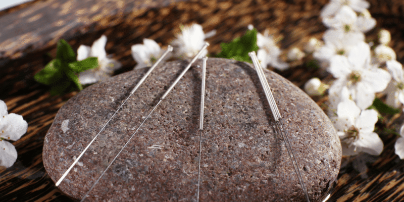 acupuncture treatment